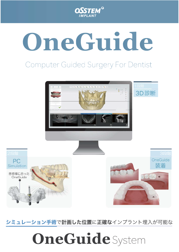 OneGuide Kit