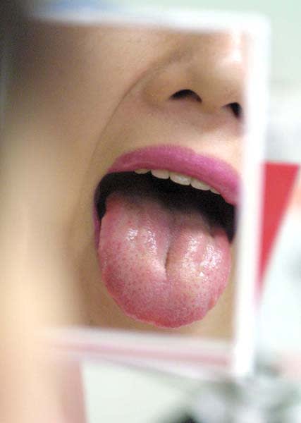 水分摂取量は適正？ 「舌」の状態を見れば体の異常がわかる