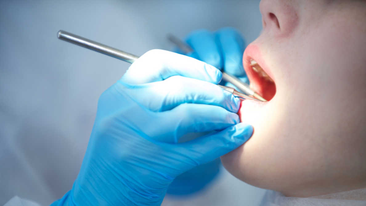 新型コロナウイルスの歯周病治療への影響が明らかに