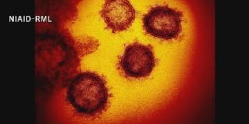 速報　北海道の新たな感染138人、死亡１人…札幌市以外で５割近く、デルタ疑い最多の65人