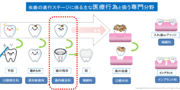 ＜日本歯内療法学会 ニュースレターvol.5＞ 11月8日は歯や口の健康を考える「いい歯の日」
