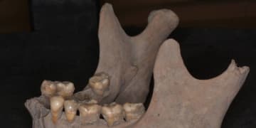 江戸時代も「歯周病」に悩まされていた!? 現代と原因菌に違いも…研究者に当時の“歯磨き”を聞いた