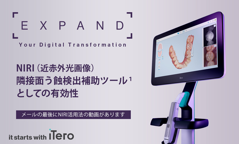 【iTero】Expand Your Digital Transformation(1)　NIRI（近赤外光画像）隣接面う蝕検出補助ツールとしての有効性