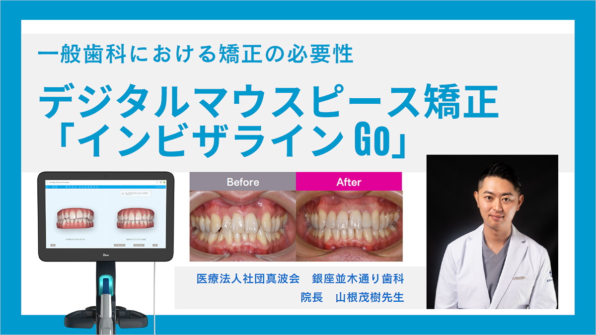 【無料ウェビナー】一般歯科における矯正の必要性 デジタルマウスピース矯正 「インビザライン Go」