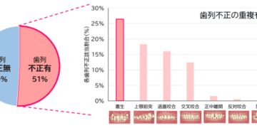 ライオン×青森県黒石市×弘前大学の共同研究　歯並びの状態と日常の生活習慣や癖が関係する可能性を確認