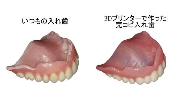 【プレスリリース】人の入れ歯は使えない！防災意識の高まりで注目の予備入れ歯　3Dプリンターで完コピに。開始から500個突破！