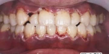 ただの歯周病から死に…“加齢”でスルーしてはいけない、名医たちが警告する「大病のサイン」