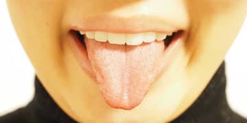 加齢とともに増加する「舌苔」　高齢者は誤嚥性肺炎の原因になることも　医師が解説