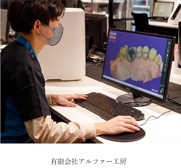 【プレスリリース】日本初、IOSデータの自動一元管理が可能なデジタル歯科技工指示書のβ版をリリース。～歯科技工士と歯科医師のDXを加速させるサービスを提供～