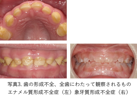出典：日本小児歯科学会