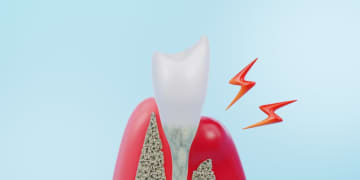 歯周病の進行度には『ジンジバリス菌』が影響!? 歯科医が解説、凶悪菌の活性を高めてしまう条件とは
