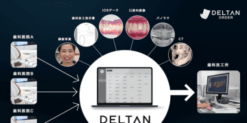 歯科デジタル技工データの自動一元管理システム「DELTAN ORDER」正式版リリース