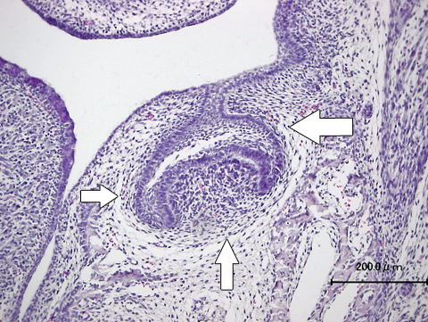 マウスの帽状期の歯胚