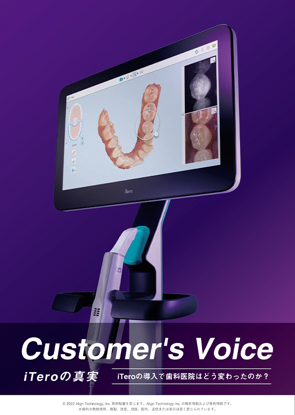 Customer's voice iTeroの真実 Vol.1