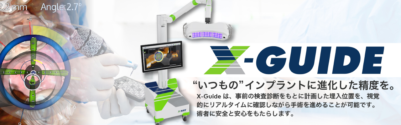 X-GUIDE