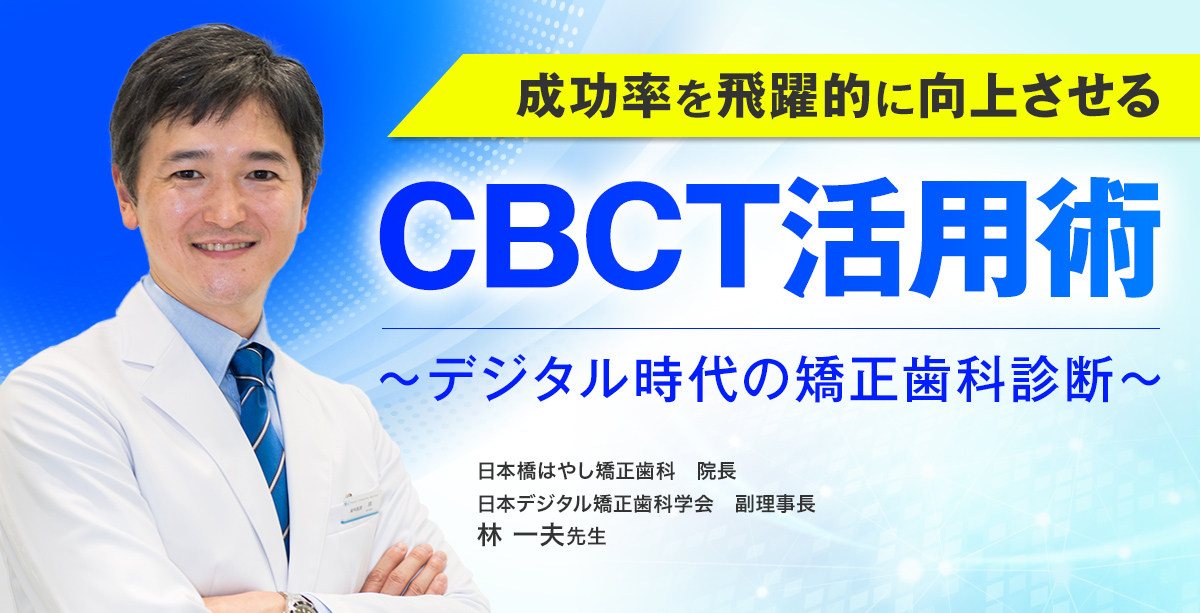 成功率を飛躍的に向上させるCBCT活用術　-デジタル時代の矯正歯科診断-